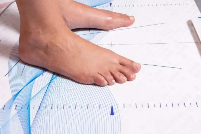 Fisioterapia podológica — Estudio de la Pisada en Valencia