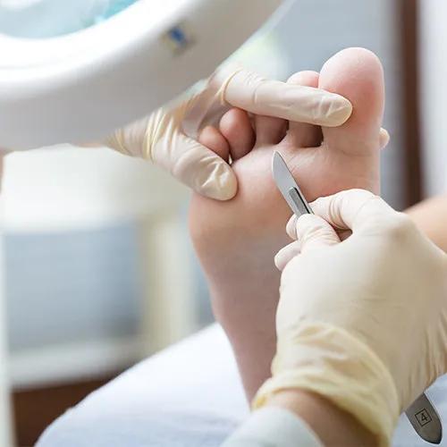 Fisioterapia podológica — Quiropodia en Valencia